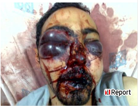 Picture 1 Iranian sudent beat by Basij forces.